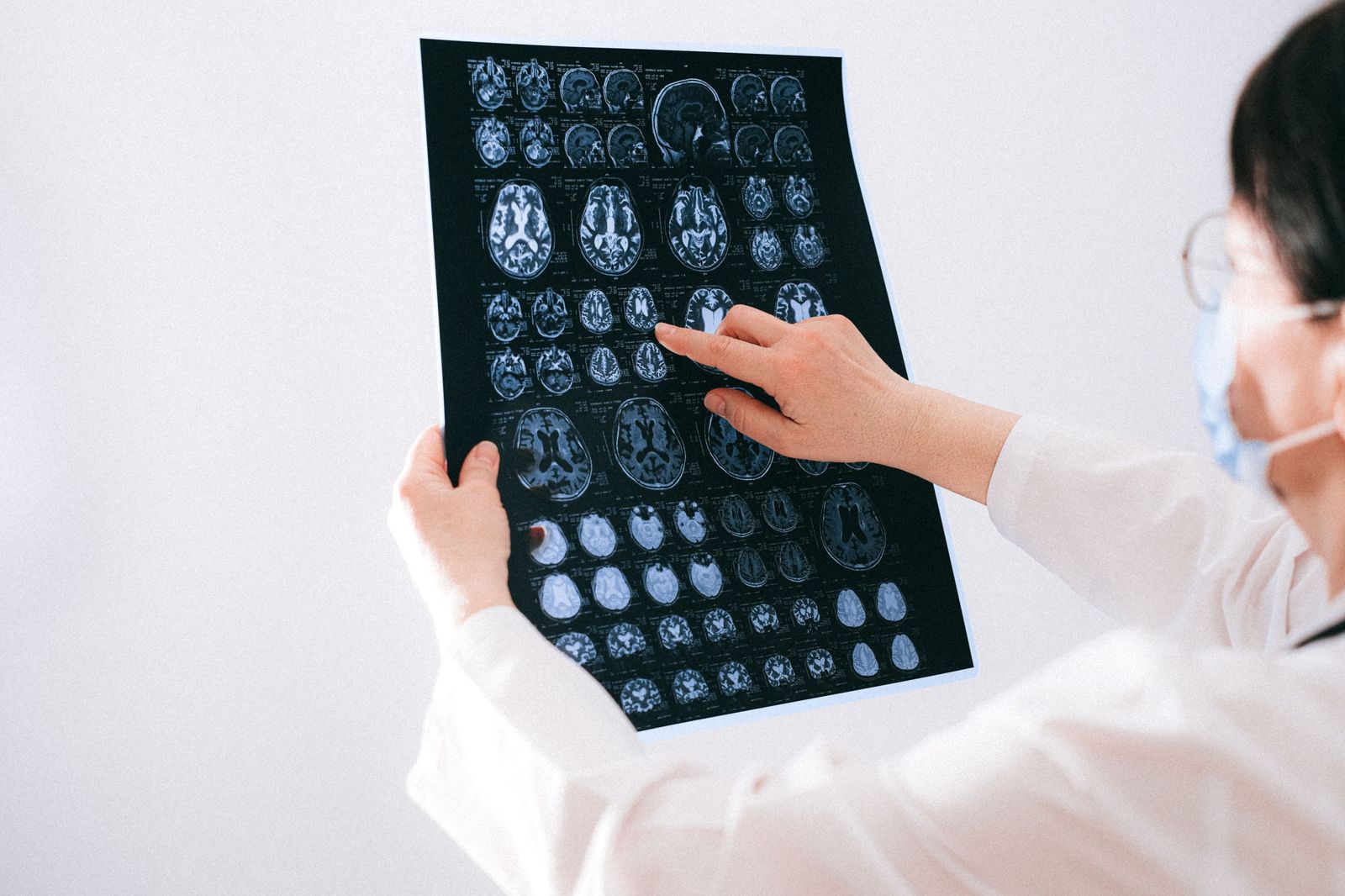 Doctor reviewing brain scans